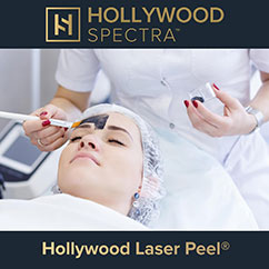 Hollywood laser Peel au Centre laser Bethune